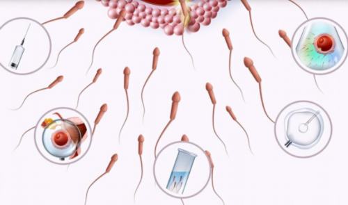 2026年长沙试管婴儿费用明细及出院总价预估