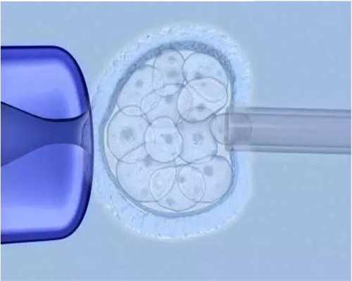 育儿假工资发放标准与产假权益详解