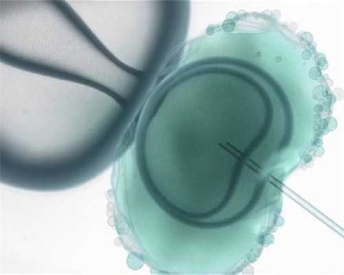 第三代试管婴儿技术能否选择性别及费用解析