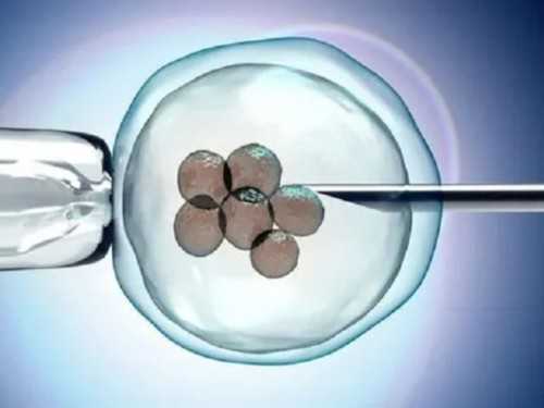 2026年长沙供卵生男孩费用明细与无需等待试管机构推荐